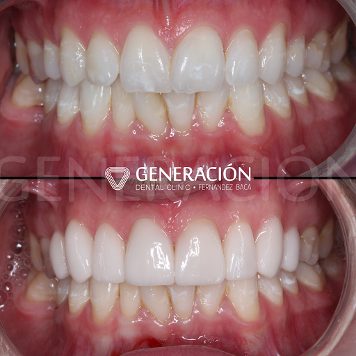 Generación Dental Clinic Clínica Dental Fernández-Baca