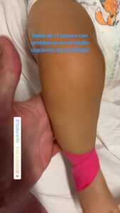 Osteopatía en Fuengirola-Osteofuengirola