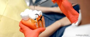 [num_X] Mejores Endodoncistas de Málaga - 55