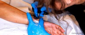 Los [num_X] mejores servicios de eliminación de tatuajes en Málaga - 27