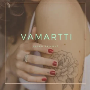Vamartti láser remove